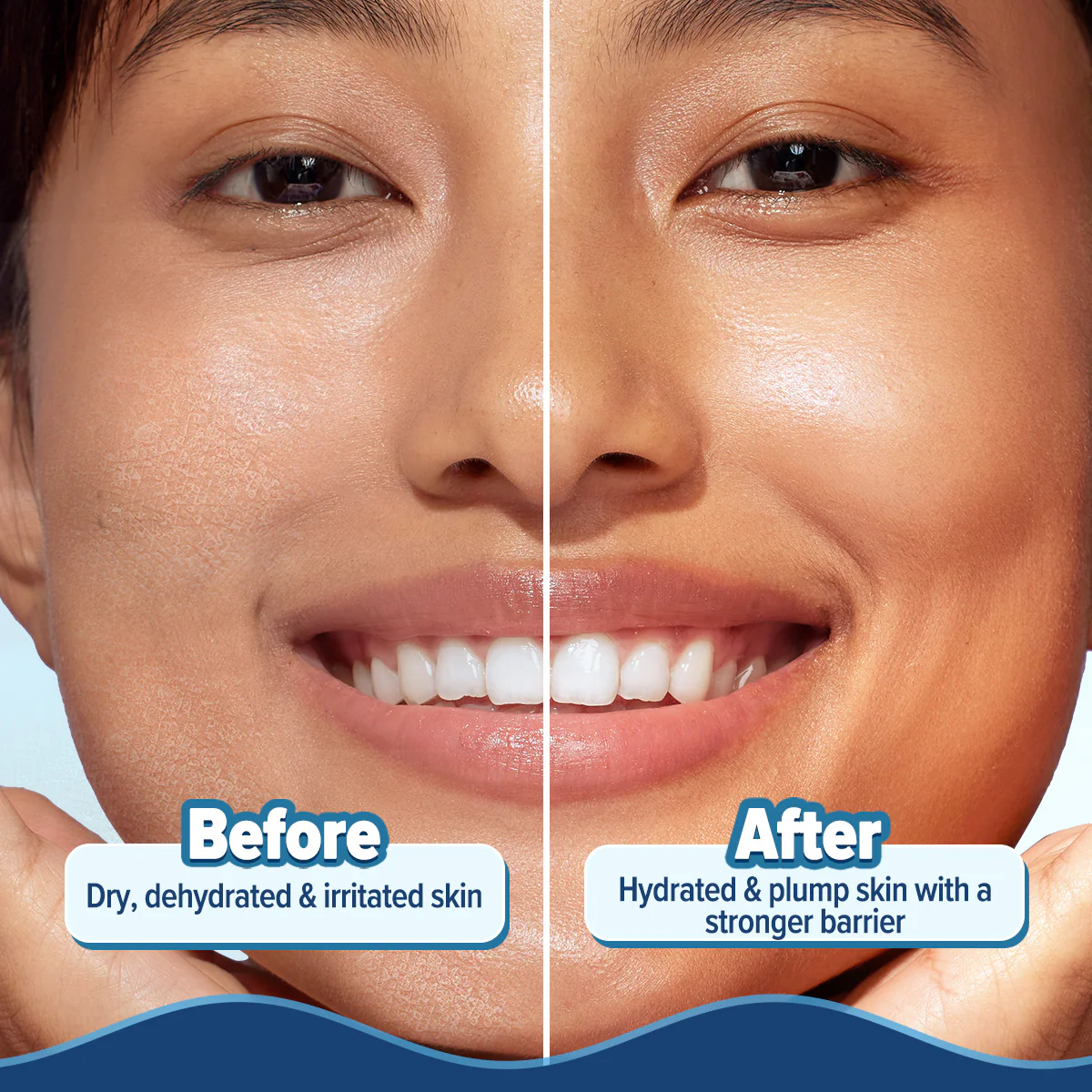 5 Barrier+ Hydra Gel Moisturizer with Avocado & 5 Essential Ceramides - 200 g (Pack of 2) - Image 6