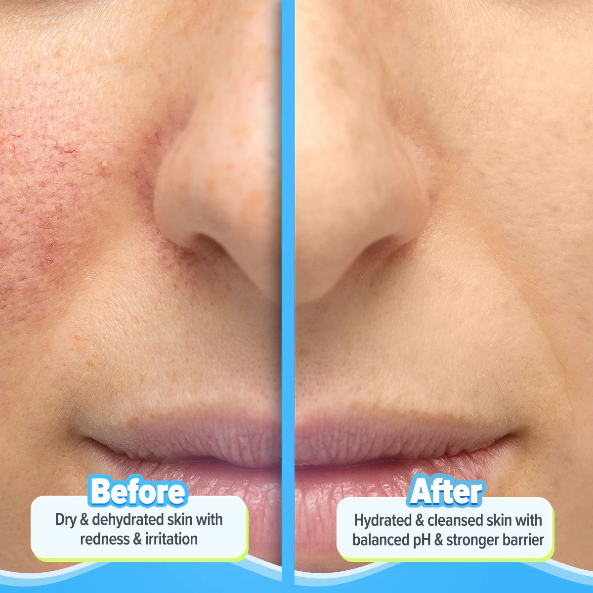 5 Barrier+ Repair Gentle Cleanser with Avocado & 5 Essential Ceramides - 100 ml - Image 5