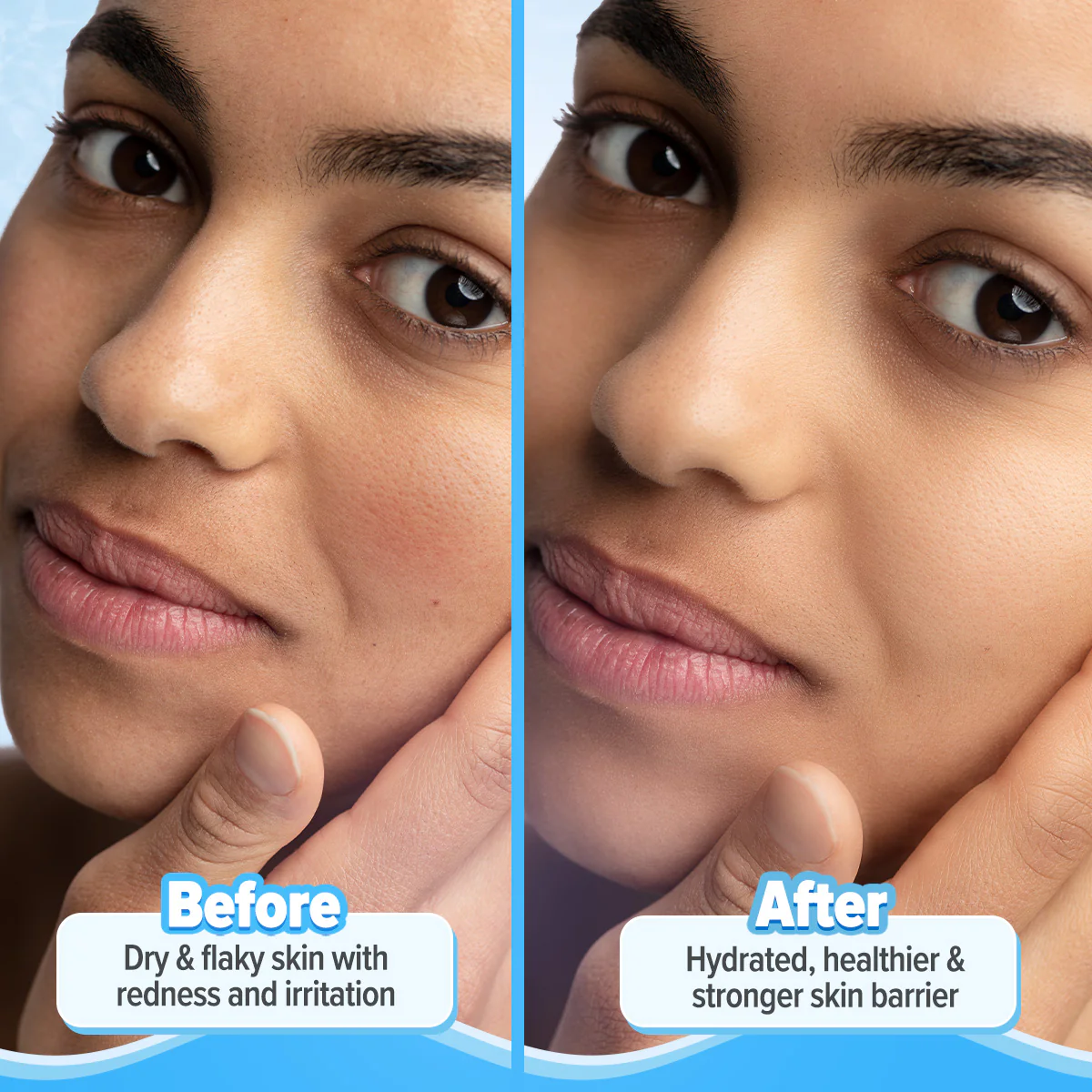5 Barrier+ Repair Moisturizer with Avocado & 5 Essential Ceramides - 100g - Image 7