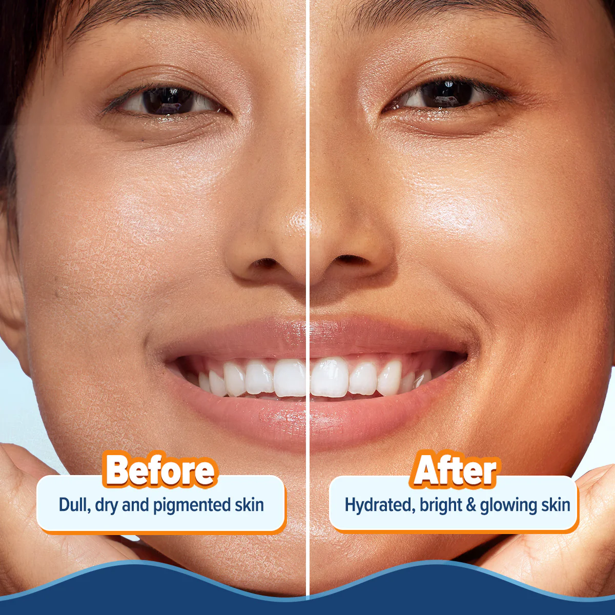 Glow+ Hydra Gel Moisturizer with Vitamin C & Papaya - 200 g - Image 8