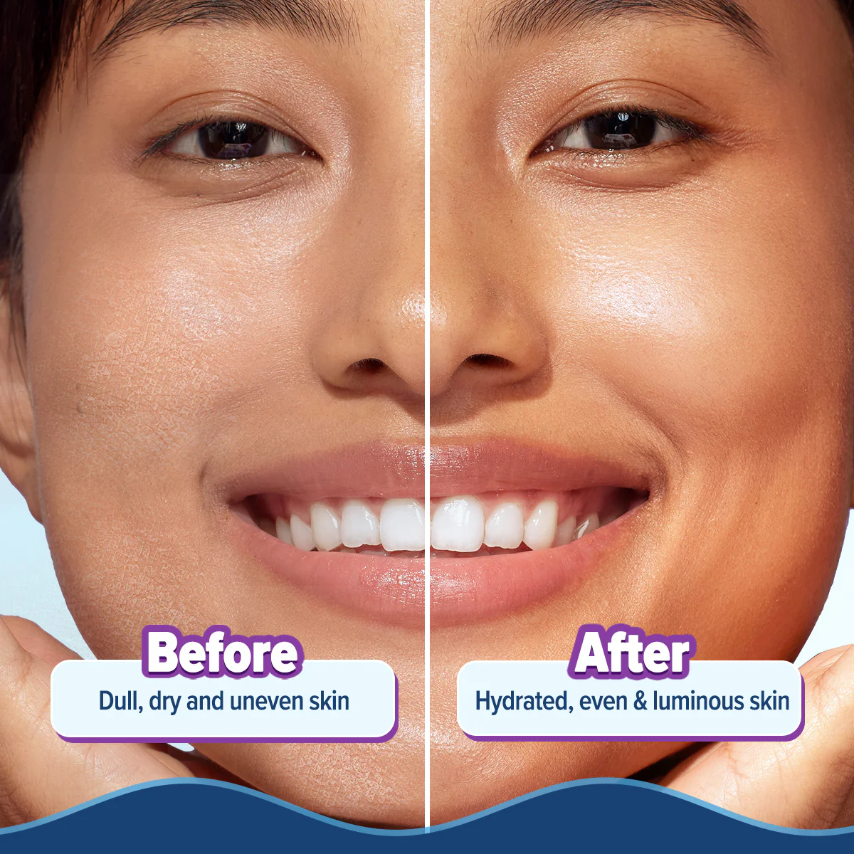 Illuminate + Hydra Gel Moisturizer with Wild Berries & Alpha Arbutin - 200g - Image 7